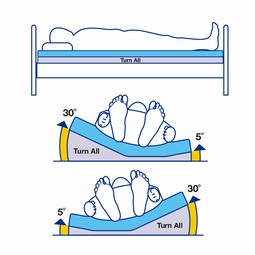 TurnAll - aut. kipsystem som lejrer i 30 grader sideleje, bariatrisk TurnAll - aut. kipsystem som lejrer i 30 grader sideleje, bariatrisk