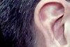 Hearing impairment