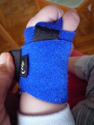 HandAid handsplints